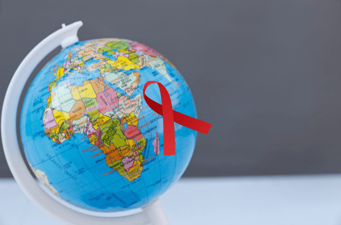 HIV AIDS