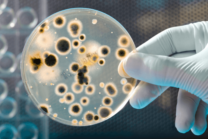 Bacteria Detection